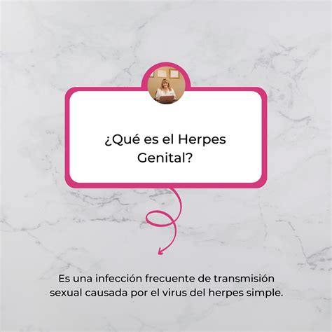 ¿Puedo contagiar de herpes genital a mi novio incluso。